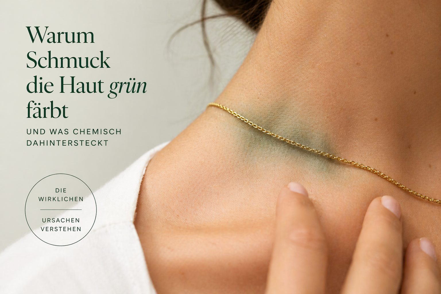 Warum Schmuck die Haut grün färbt - und was chemisch dahintersteckt